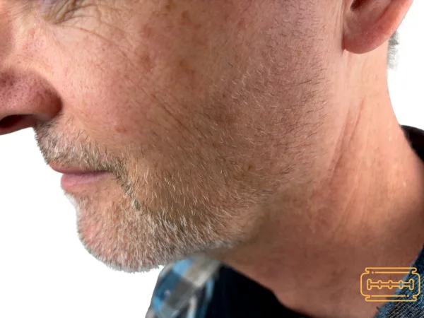 Man with stubble beard. Focus on cheek and jawline.